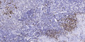 Immunohistochemical analysis of paraffin-embedded human tonsil. 1, Antibody was diluted at 1:200 (4°C overnight). 2, Tris-EDTA, pH9.0 was used for antigen retrieval. 3, Secondary antibody was diluted at 1:200 (room temperature, 45min).