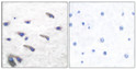 Immunohistochemistry analysis of paraffin-embedded human brain, using PDGF Receptor beta (Phospho-Tyr751) Antibody. The picture on the right is blocked with the phospho peptide.