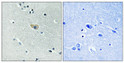 Immunohistochemical analysis of paraffin-embedded Human brain. Antibody was diluted at 1:100 (4°C overnight). High-pressure and temperature Tris-EDTA, pH8.0 was used for antigen retrieval. Negetive contrl (right) obtaned from antibody was pre-absorbed by immunogen peptide. Immunohistochemical analysis of paraffin-embedded Human brain. Antibody was diluted at 1:100 (4°C overnight). High-pressure and temperature Tris-EDTA, pH8.0 was used for antigen retrieval. Negetive contrl (right) obtaned from antibody was pre-absorbed by immunogen peptide.