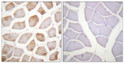 Immunohistochemistry analysis of paraffin-embedded human skeletal muscle, using DAPK2 (Phospho-Ser318) Antibody. The picture on the right is blocked with the phospho peptide.