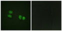 Immunofluorescence analysis of HeLa cells, using DDX5/DEAD-box Protein 5 (Phospho-Tyr593) Antibody. The picture on the right is blocked with the phospho peptide.