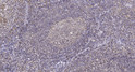 Immunohistochemical analysis of paraffin-embedded human tonsil. 1, Tris-EDTA, pH 9.0 was used for antigen retrieval. 2, STJ91330