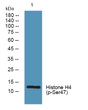 Western blot analysis of lysates from A431 cells, primary antibody was diluted at 1:1000, 4°C overnight STJ91343