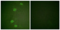 Immunofluorescence analysis of HeLa cells, using Retinoblastoma (Phospho-Ser249) Antibody. The picture on the right is STJ91344