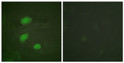 Immunofluorescence analysis of HeLa cells, using HIRA (Phospho-Thr555) Antibody. The picture on the right is blocked with the phospho peptide.
