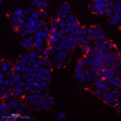 Immunofluorescence analysis of Caco2 cells. 1, Primary antibody was diluted at 1:100 (4℃ overnight). 2, Goat Anti STJ91368