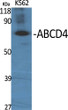 Western Blot analysis of various cells using ABCD4 Polyclonal Antibody diluted at 1:500 STJ91415