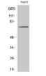 Western blot analysis of HepG2 cells using ABCD4 polyclonal antibody diluted at 1:500 STJ91415