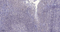 Immunohistochemical analysis of paraffin-embedded human tonsil. 1, Antibody was diluted at 1:200 (4° overnight). 2, STJ91415