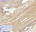 Immunohistochemical analysis of paraffin-embedded Human-Appendix tissue. 1, Actin Beta Polyclonal Antibody was diluted at 1:200 (4°C, overnight). 2, Sodium citrate pH 6.0 was used for antibody retrieval (>98°C, 20min). 3, Secondary antibody was diluted at 1:200 (room tempeRature, 30min). Negative control was used by secondary antibody only.