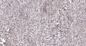 Immunohistochemical analysis of paraffin-embedded human small intestinal stromal tumor. 1, Tris-EDTA, pH 9.0 was used STJ91484