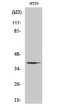 Western blot analysis of various cells using AHA-1 polyclonal antibody diluted at 1:1000 STJ91511