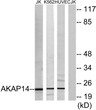 Western blot analysis of lysates from Jurkat, K562, and HUVEC cells, using AKAP14 Antibody. The lane on the right was STJ91527