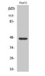 Western blot analysis of various cells using AKAP 79 polyclonal antibody diluted at 1:1000 STJ91532