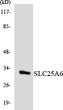Western blot analysis of the lysates from K562 cells using SLC25A6 antibody. STJ91606