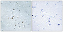 Immunohistochemical analysis of paraffin-embedded Human brain. Antibody was diluted at 1:100 (4°C overnight). High-pressure and temperature Tris-EDTA, pH8.0 was used for antigen retrieval. Negetive contrl (right) obtaned from antibody was pre-absorbed by immunogen peptide.