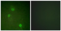 Immunofluorescence analysis of HeLa cells, using AurB Antibody. The picture on the right is blocked with the synthesized peptide.