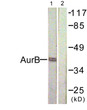Western blot analysis of lysates from COS7 cells, treated with Nocodazole 1ug/ml 16h, using AurB Antibody. The lane on the right is blocked with the synthesized peptide.