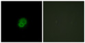 Immunofluorescence analysis of HepG2 cells using ARMCX2 Antibody. The picture on the right is blocked with the STJ91697