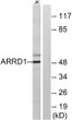 Western blot analysis of lysates from Jurkat cells, using ARRD1 Antibody. The lane on the right was blocked with the STJ91703