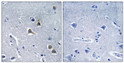 Immunohistochemistry analysis of paraffin-embedded human brain tissue, using ARRDC2 Antibody. The picture on the right is blocked with the synthesized peptide.