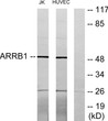 Western blot analysis of lysates from Jurkat and HUVEC cells, using ARRB1 Antibody. The lane on the right was blocked STJ91709