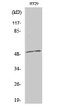 Western blot analysis of various cells using AR-β1 polyclonal antibody STJ91724