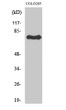 Western blot analysis of various cells using ATF-6β polyclonal antibody STJ91754