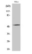 Western blot analysis of various cells using ATF-7 polyclonal antibody STJ91755