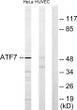 Western blot analysis of lysates from HeLa and HUVEC cells, using ATF7 Antibody. The lane on the right was blocked with STJ91755