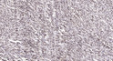 Immunohistochemical analysis of paraffin-embedded human small intestinal stromal tumor. 1, Tris-EDTA, pH 9.0 was used STJ91755