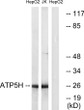Western blot analysis of lysates from HepG2 and Jurkat cells, using ATP5H Antibody. The lane on the right was blocked STJ91771