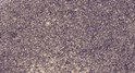 Immunohistochemical analysis of paraffin-embedded human uterus. 1, Antibody was diluted at 1:200 (4° overnight). 2, STJ91772