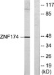 Western blot analysis of lysates from HeLa cells, using ZNF174 Antibody. The lane on the right was blocked with the STJ91790