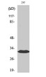 Western blot analysis of various cells using BAM32 Polyclonal Antibody STJ91815