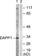 Western blot analysis of lysates from 293 cells treated with Insulin 0.01U/ml for 2', using DAPP1 Antibody. The lane on STJ91815