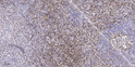 Immunohistochemical analysis of paraffin-embedded human tonsil. 1, Tris-EDTA, pH 9.0 was used for antigen retrieval. 2, STJ91815