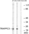 Western blot analysis of lysates from COLO and Jurkat cells, using TRAPPC3 Antibody. The lane on the right is blocked STJ91851