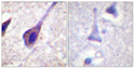 Immunohistochemistry analysis of paraffin-embedded human brain, using BID Antibody. The picture on the right is blocked with the synthesized peptide.