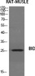 Western blot analysis of various cells using BID Polyclonal Antibody diluted at 1：1000