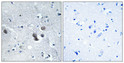 Immunohistochemical analysis of paraffin-embedded Human brain. Antibody was diluted at 1:100 (4°C overnight). High-pressure and temperature Tris-EDTA, pH8.0 was used for antigen retrieval. Negetive contrl (right) obtaned from antibody was pre-absorbed by immunogen peptide.