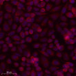 Immunofluorescence analysis of Siha cells. 1, Primary antibody was diluted at 1:100 (4℃ overnight). 2, Goat Anti Rabbit STJ91871