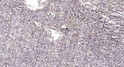 Immunohistochemical analysis of paraffin-embedded human spleen. 1, Antibody was diluted at 1:200 (4°C overnight). 2, STJ91880