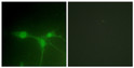 Immunofluorescence analysis of NIH/3T3 cells, using Breast Tumor Kinase Antibody. The picture on the right is blocked with the synthesized peptide.