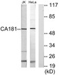 Western blot analysis of lysates from Jurkat and HeLa cells, using CA181 Antibody. The lane on the right was blocked STJ91927