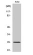 Western Blot analysis of various cells using C1q-B Polyclonal Antibody diluted at 1:1000 STJ91928