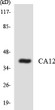 Western blot analysis of the lysates from COLO205 cells using CA12 antibody. STJ91945