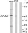 Western blot analysis of lysates from HepG2 and mouse muscle cells, using ADCK3 Antibody. The lane on the right was STJ91948