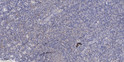 Immunohistochemical analysis of paraffin-embedded human tonsil. 1, Antibody was diluted at 1:200 (4° overnight). 2, STJ91948
