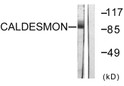 Western blot analysis of lysates from HeLa cells, treated with EGF 200ng/ml 30', using Caldesmon Antibody. The lane on the right is blocked with the synthesized peptide.
